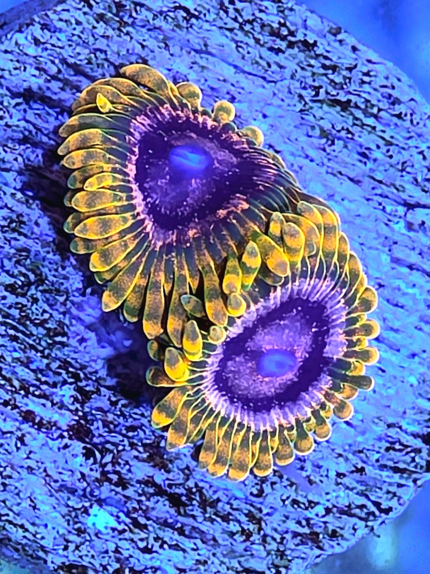 Acid Reflux Zoa